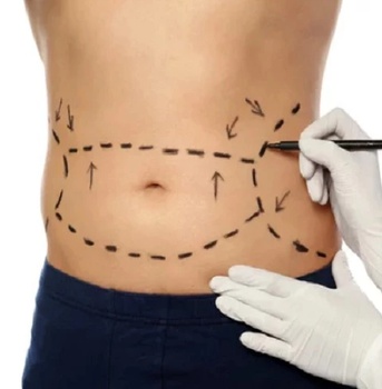 body contouring picture